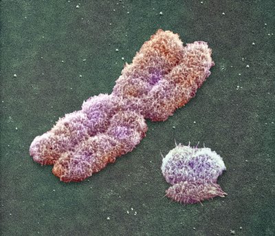 cromosomaxey.jpg